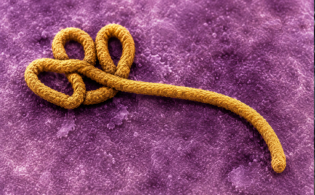 mikroskopische aufnahme von ebola virus